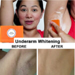 Kojic acid Soap for face and body