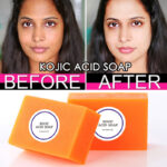 Kojic acid Soap for face and body
